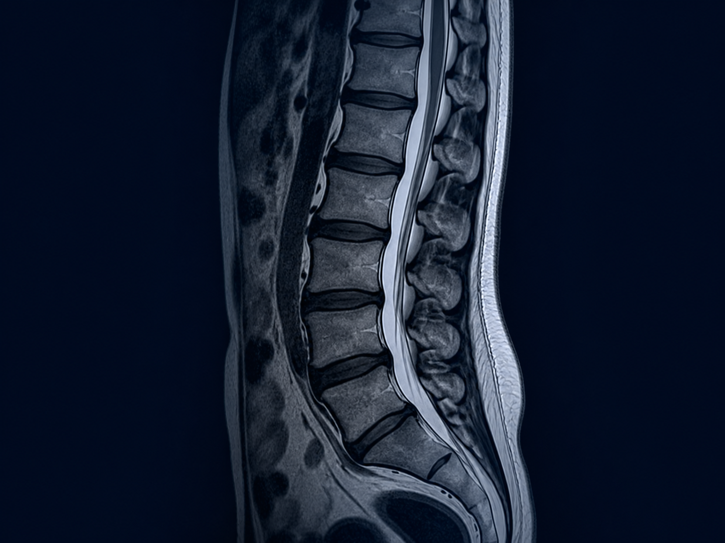 Imagen diagnóstica ilustrativa de columna lumbar
