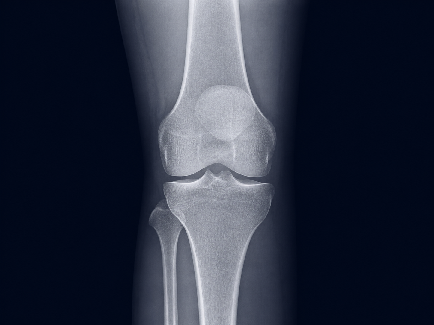 Imagen diagnóstica ilustrativa de rodilla